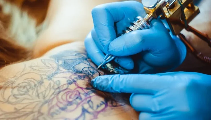 What to Do If You Dislike an Old Tattoo